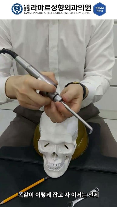 성형수술의 끝판! 성형외과 윤곽수술을 알려드립니다. 저희병원에서 사용하는 수술기구, 그리고 윤곽3종 모의수술....!! 관련 이미지 54