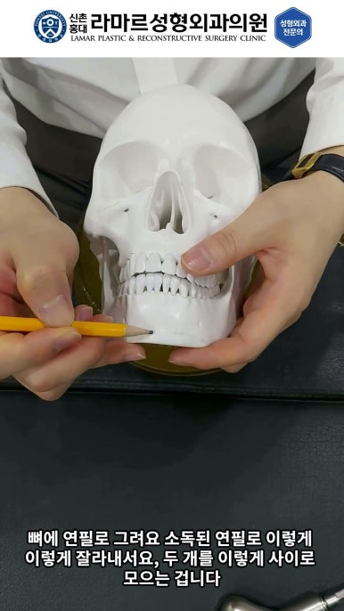 성형수술의 끝판! 성형외과 윤곽수술을 알려드립니다. 저희병원에서 사용하는 수술기구, 그리고 윤곽3종 모의수술....!! 관련 이미지 51
