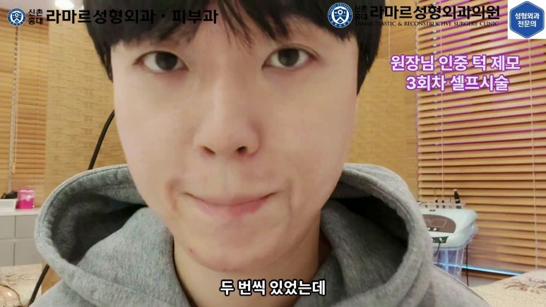 [성형외과 전문의의 셀프시술 제8편] 인중, 아래턱 제모 4회차 결과 공개! 관련 이미지 76