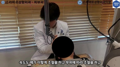 21세 여성 코 지름 1cm 점 제거수술 : 나선피판술(Spiral Flap) 수술전~5달 경과. (+쌍꺼풀수술, 코필러) 관련 이미지 42