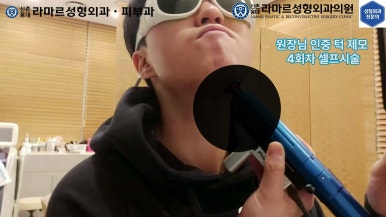 [성형외과 전문의의 셀프시술 제8편] 인중, 아래턱 제모 4회차 결과 공개! 관련 이미지 107
