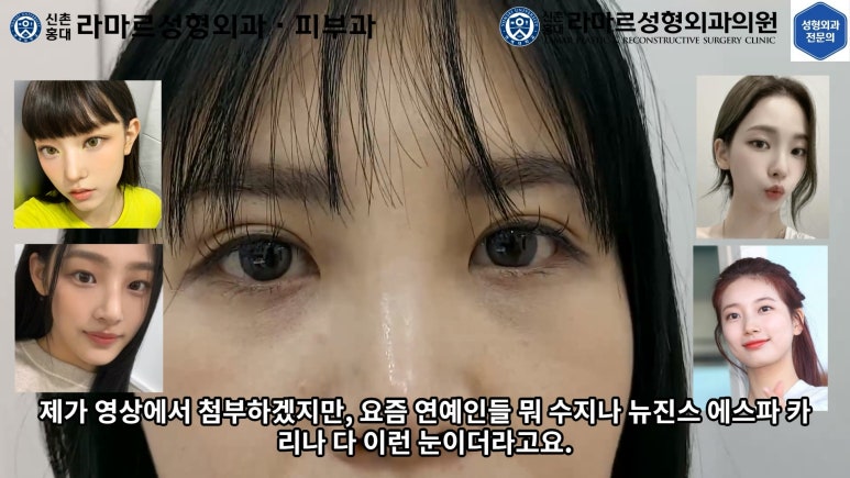 30대 여성 "쌍꺼풀+눈매교정" 상담, 디자인, 수술 전체 과정, 결과, 경과 모두 공개합니다. 관련 이미지 53