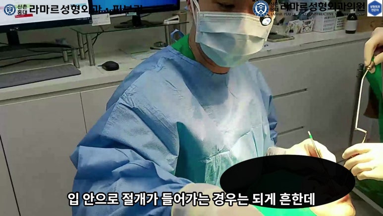 파라핀 필러 입 안 절개로 흉터없이 빼내기! 관련 이미지 34