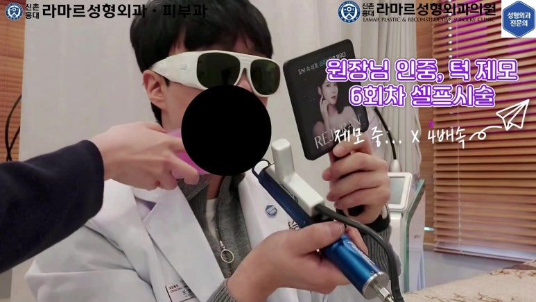 [성형외과 전문의의 셀프시술 제9편] 인중, 아래턱 제모 5,6회차 결과 공개! 관련 이미지 62