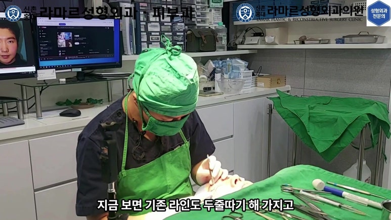 29세 남자, 소시지 쌍꺼풀 두줄따기로 낮추기 (쌍꺼풀 재수술) 관련 이미지 44