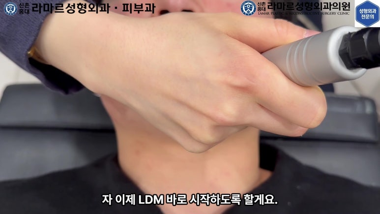 개에 물려 입술 1/3이 뜯긴 19세 남자분 치료 및 흉터 성형수술& 레이저 후기....! 관련 이미지 84