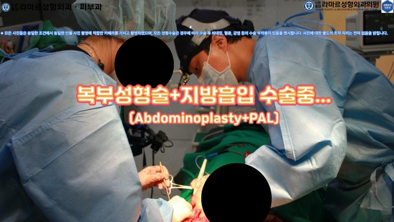 '복부성형술+지방흡입(Abdominoplasty+PAL)' 으로 뱃살 끝장내기! 관련 이미지 40