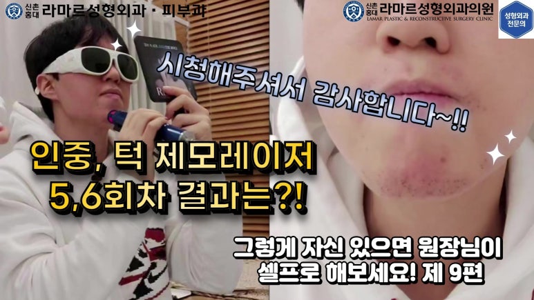 [성형외과 전문의의 셀프시술 제9편] 인중, 아래턱 제모 5,6회차 결과 공개! 관련 이미지 95
