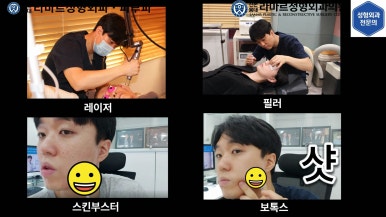 [성형외과 전문의의 셀프시술 제8편] 인중, 아래턱 제모 4회차 결과 공개! 관련 이미지 27