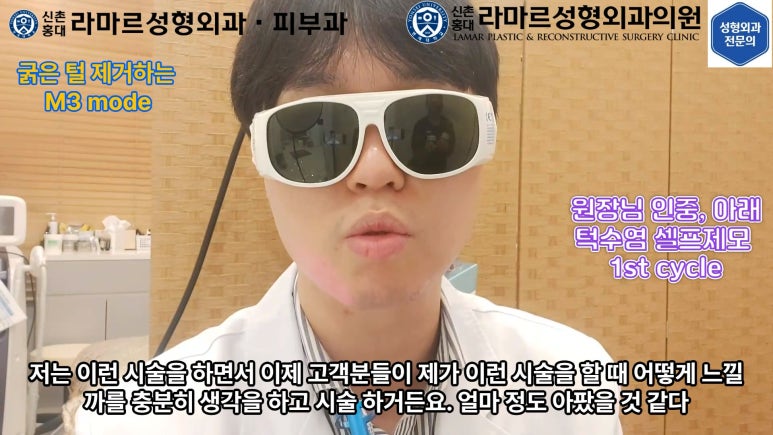 [모영웅 대표원장님 셀프시술 제7편] 인중, 아래턱 제모 시술과정 공개! 관련 이미지 26