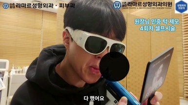 [성형외과 전문의의 셀프시술 제8편] 인중, 아래턱 제모 4회차 결과 공개! 관련 이미지 133