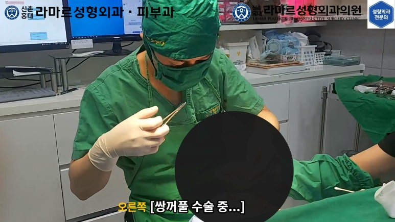 30대 여성 "쌍꺼풀+눈매교정" 상담, 디자인, 수술 전체 과정, 결과, 경과 모두 공개합니다. 관련 이미지 28