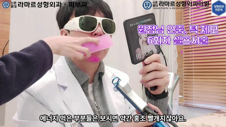 [성형외과 전문의의 셀프시술 제9편] 인중, 아래턱 제모 5,6회차 결과 공개! 관련 이미지 60