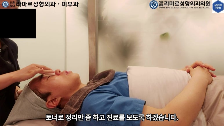 저의 코 모공, 블랙헤드 관리 실제 영상 및 후기~! 관련 이미지 76