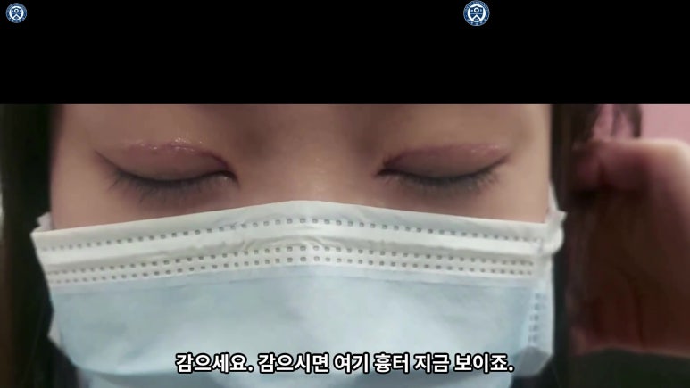 매몰 쌍꺼풀 풀고 절개쌍꺼풀로 바꾸는 쌍꺼풀 재수술!! 관련 이미지 68