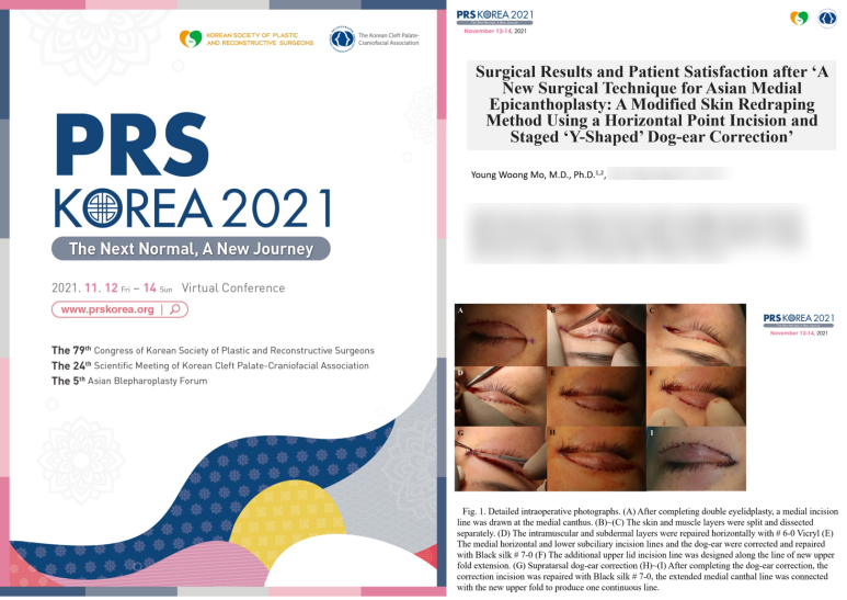 2022년 7월 25일 처음으로 블로그를 시작하며... 관련 이미지 29