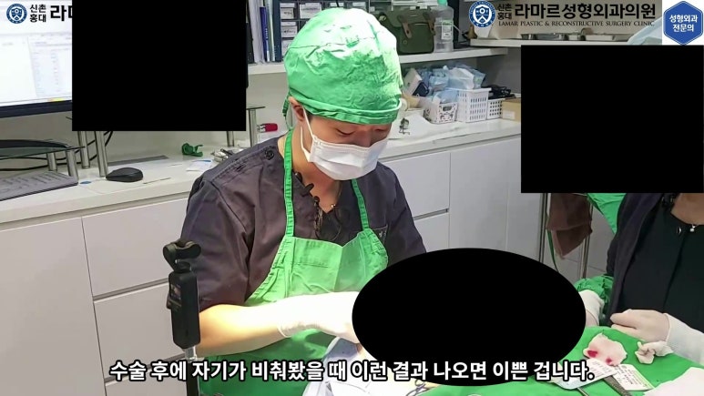 매몰 쌍꺼풀 풀고 절개쌍꺼풀로 바꾸는 쌍꺼풀 재수술!! 관련 이미지 42