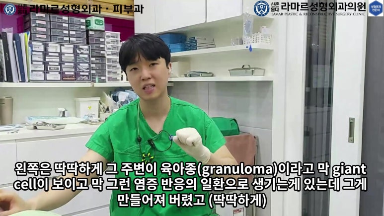 파라핀 필러 입 안 절개로 흉터없이 빼내기! 관련 이미지 16