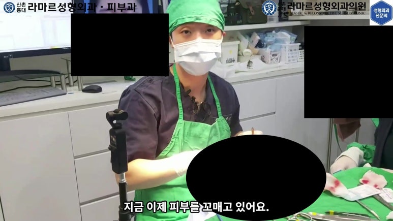매몰 쌍꺼풀 풀고 절개쌍꺼풀로 바꾸는 쌍꺼풀 재수술!! 관련 이미지 25