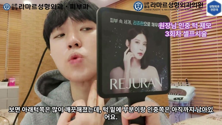 [성형외과 전문의의 셀프시술 제8편] 인중, 아래턱 제모 4회차 결과 공개! 관련 이미지 50