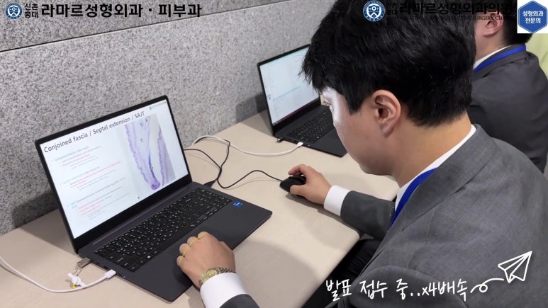 이대역 성형외과 개원의 퇴근 후 V-log 제 8편 : 눈성형연구회 학술심포지엄 발표 (눈성형연구회 학술위원) 관련 이미지 30