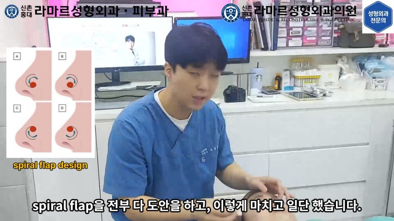 지름 1cm 코 점 제거수술 : 나선피판술(Spiral Flap) 수술전~1달 경과. (Feat. 턱끝필러+사각턱 보톡스) 관련 이미지 49