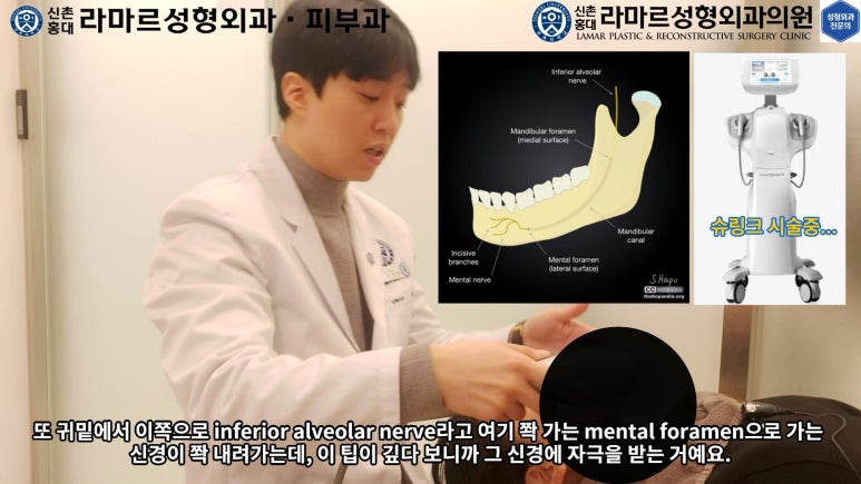 슈링크+글로브리프팅 (Shurink+Glove Lifting) : 우리병원 얼짱 코디선생님 얼굴라인 유지위해 매달하는 그 시술! 모든 과정 보여드립니다. 관련 이미지 93