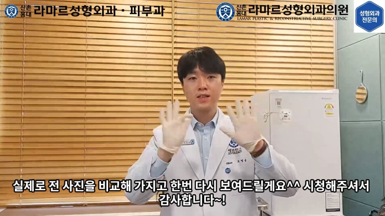지름 1cm 코 점 제거수술 : 나선피판술(Spiral Flap) 수술전~1달 경과. (Feat. 턱끝필러+사각턱 보톡스) 관련 이미지 126