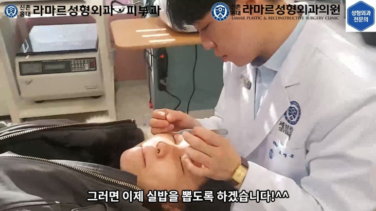 지름 1cm 코 점 제거수술 : 나선피판술(Spiral Flap) 수술전~1달 경과. (Feat. 턱끝필러+사각턱 보톡스) 관련 이미지 65
