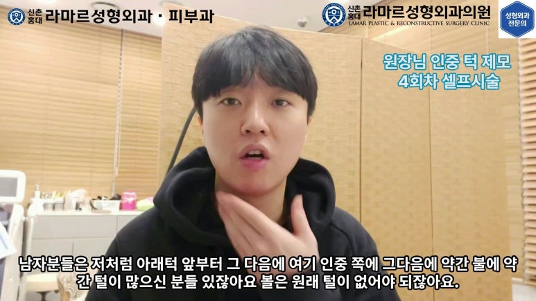 [성형외과 전문의의 셀프시술 제8편] 인중, 아래턱 제모 4회차 결과 공개! 관련 이미지 151