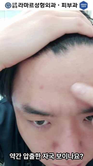 [신촌홍대 라마르성형외과 피부과] 저희병원의 기본 여드름 관리 소개해드립니다! 관련 이미지 81