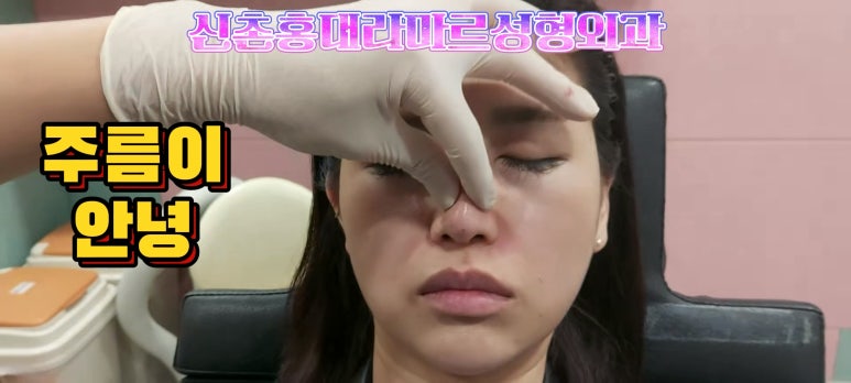 30대 여성 팔자필러 시술: 팔자주름과 안전이별 하는 법 관련 이미지 9