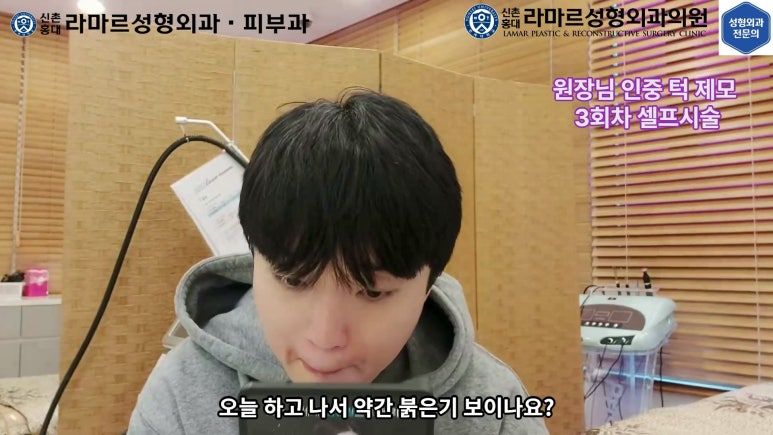 [성형외과 전문의의 셀프시술 제8편] 인중, 아래턱 제모 4회차 결과 공개! 관련 이미지 73