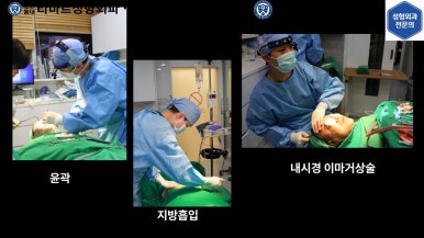 [성형외과 전문의의 셀프시술 제8편] 인중, 아래턱 제모 4회차 결과 공개! 관련 이미지 25