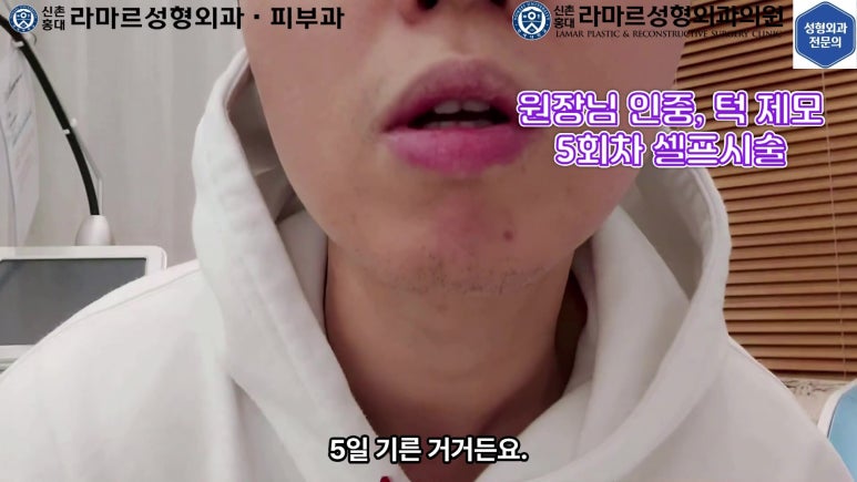 [성형외과 전문의의 셀프시술 제9편] 인중, 아래턱 제모 5,6회차 결과 공개! 관련 이미지 31