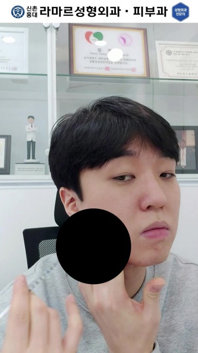 [대표원장님  셀프시술 제 10편] 또! 사각턱 보톡스 셀프시술! 관련 이미지 17