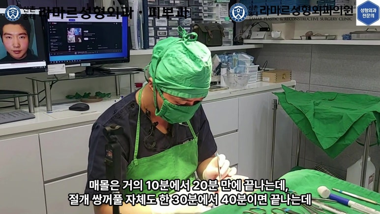 29세 남자, 소시지 쌍꺼풀 두줄따기로 낮추기 (쌍꺼풀 재수술) 관련 이미지 40