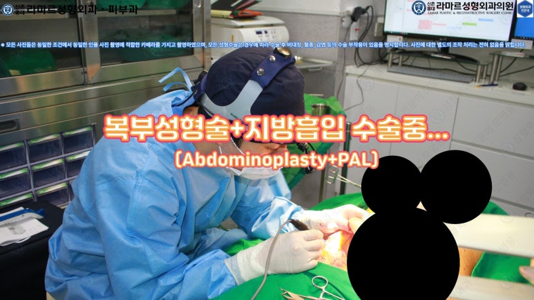 '복부성형술+지방흡입(Abdominoplasty+PAL)' 으로 뱃살 끝장내기! 관련 이미지 39