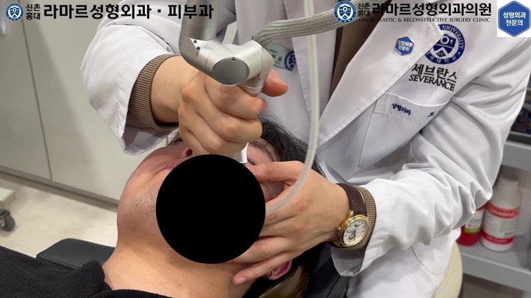 개에 물려 입술 1/3이 뜯긴 19세 남자분 치료 및 흉터 성형수술& 레이저 후기....! 관련 이미지 78