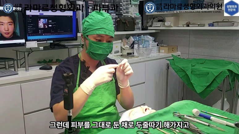 29세 남자, 소시지 쌍꺼풀 두줄따기로 낮추기 (쌍꺼풀 재수술) 관련 이미지 48
