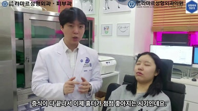 21세 여성 코 지름 1cm 점 제거수술 : 나선피판술(Spiral Flap) 수술전~5달 경과. (+쌍꺼풀수술, 코필러) 관련 이미지 13