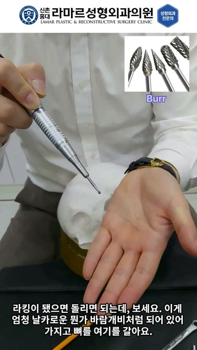 성형수술의 끝판! 성형외과 윤곽수술을 알려드립니다. 저희병원에서 사용하는 수술기구, 그리고 윤곽3종 모의수술....!! 관련 이미지 64