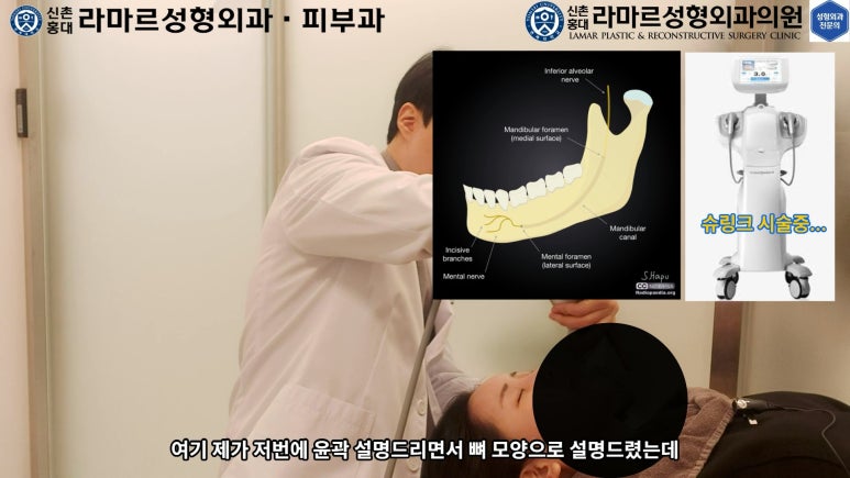 슈링크+글로브리프팅 (Shurink+Glove Lifting) : 우리병원 얼짱 코디선생님 얼굴라인 유지위해 매달하는 그 시술! 모든 과정 보여드립니다. 관련 이미지 92