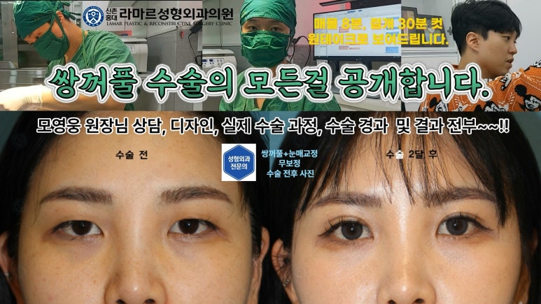 30대 여성 "쌍꺼풀+눈매교정" 상담, 디자인, 수술 전체 과정, 결과, 경과 모두 공개합니다. 관련 이미지 4