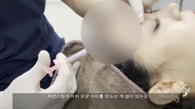 이마필러 : 21세 여성 이마필러 시술영상 관련 이미지 9
