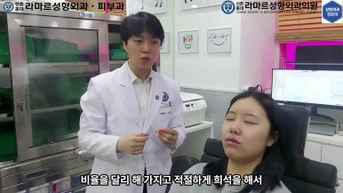 21세 여성 코 지름 1cm 점 제거수술 : 나선피판술(Spiral Flap) 수술전~5달 경과. (+쌍꺼풀수술, 코필러) 관련 이미지 26