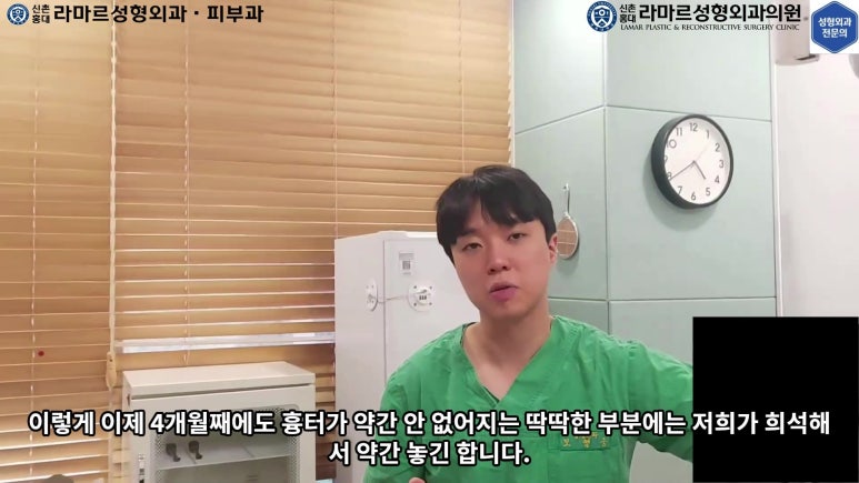 매몰 쌍꺼풀 풀고 절개쌍꺼풀로 바꾸는 쌍꺼풀 재수술!! 관련 이미지 81