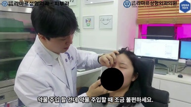 21세 여성 코 지름 1cm 점 제거수술 : 나선피판술(Spiral Flap) 수술전~5달 경과. (+쌍꺼풀수술, 코필러) 관련 이미지 31