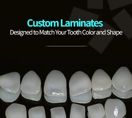 Seoul Gangnam Laminate - thestar dental clinic 관련 이미지 6