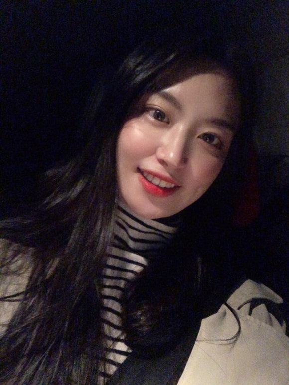 강남 앞니 부분교정, 2년 걸리는 전체 교정 말고 관련 이미지 2